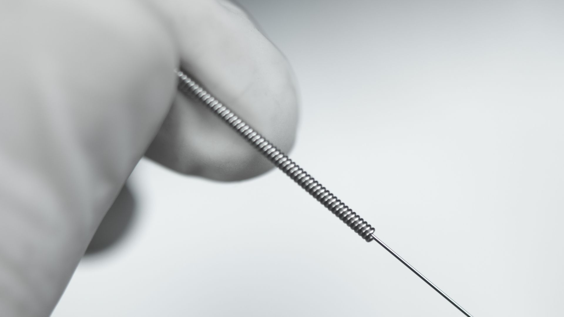 Dry Needling - Sunshine Coast Heel Pain Clinic